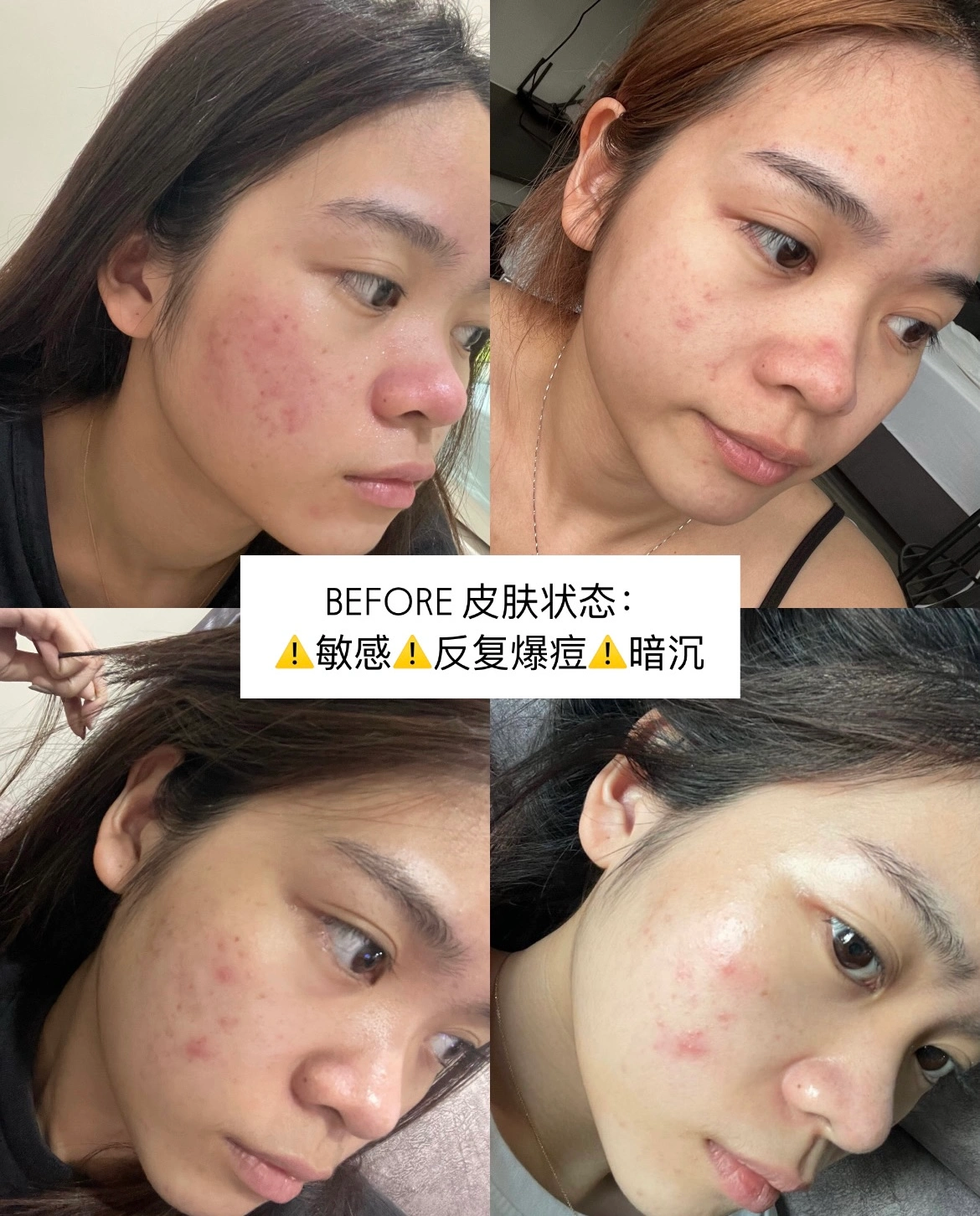 Liveon Before Result